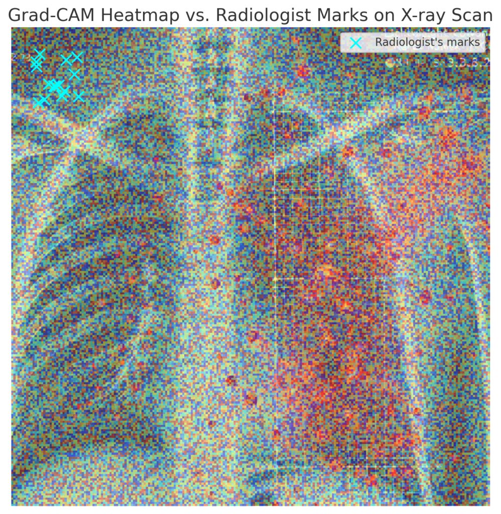  Grad-CAM reveals critical regions in medical images, helping to interpret CNN-based diagnoses.