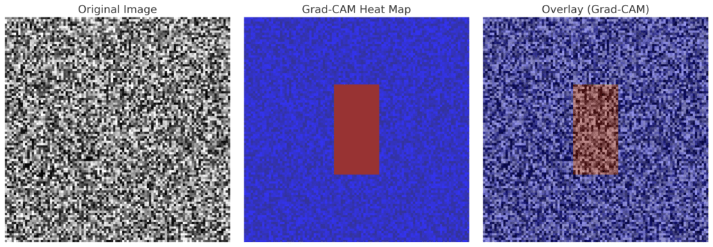 Grad-CAM heat map illustrating the regions in an image that influenced the model’s classification decision.